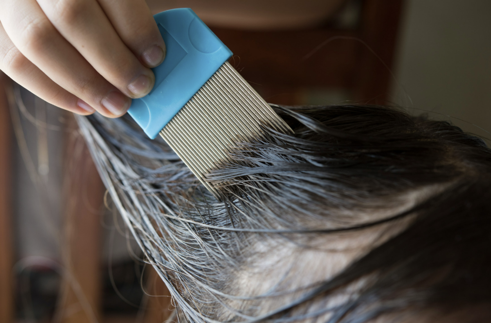 kutu rambut anak, cara menghilangkan kutu rambut, obat kutu rambut anak, pencegahan kutu rambut, Bunda, si Kecil